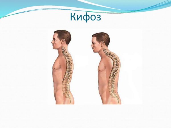 Позвонок лордоз кифоз