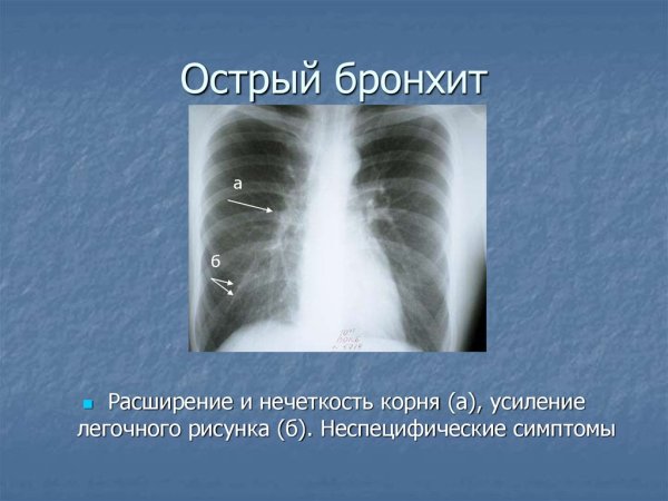 Умтление легосного рисунка