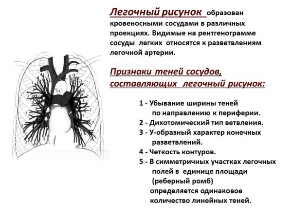 Изменение легочного рисунка