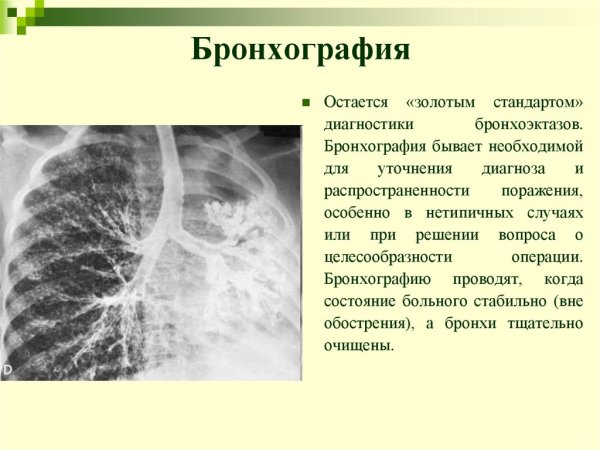 Очаговый пневмофиброз