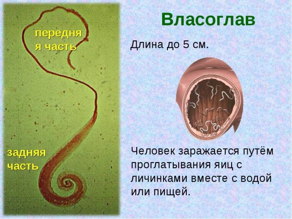 Круглые черви паразиты власоглав