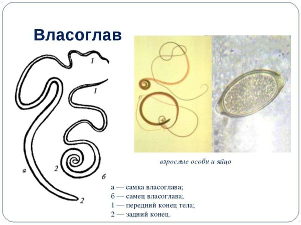 Власоглав Trichocephalus Trichiurus жизненный цикл