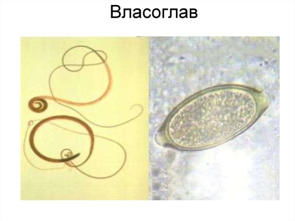 Власоглав человеческий (Trichocephalus Trichiurus)