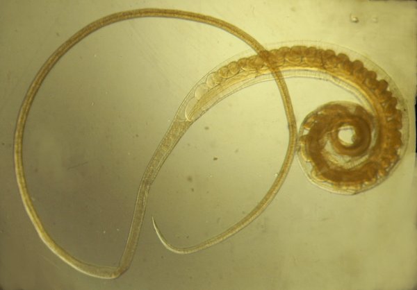 Власоглав человеческий (Trichocephalus Trichiurus)