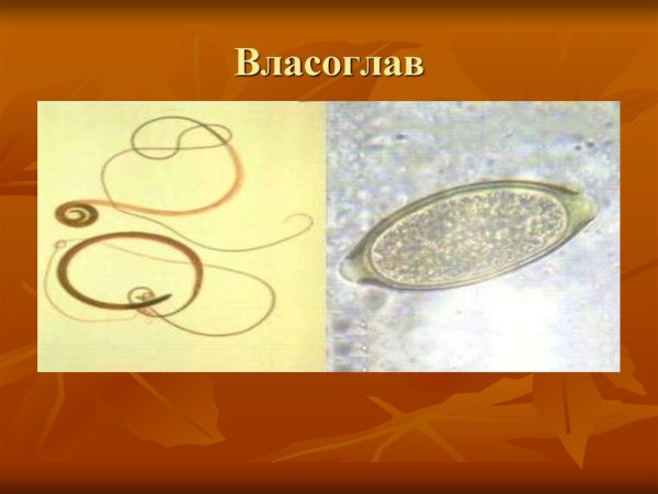 Власоглав человеческий трихоцефалез