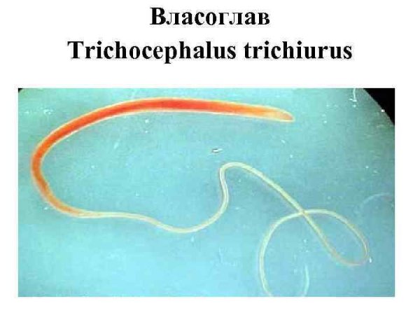 Власоглав Trichocephalus Trichiurus