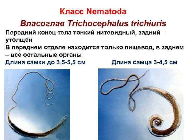 Власоглав паразитирует