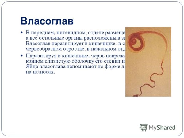 Власоглав Trichocephalus Trichiurus
