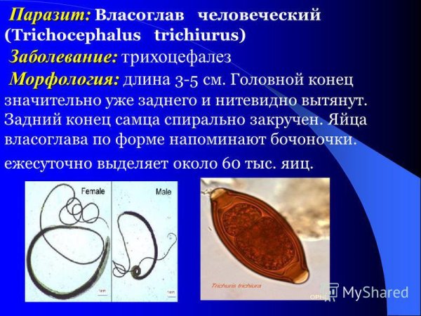 Власоглав самка самец яйцо