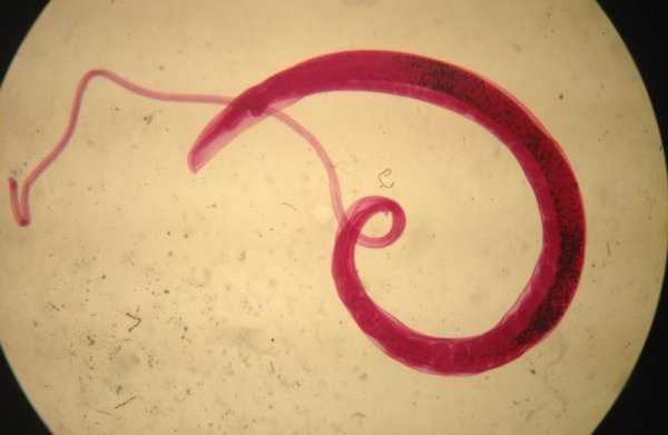 Власоглав Trichocephalus Trichiurus