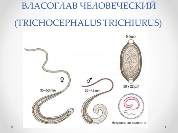 Власоглав человеческий строение