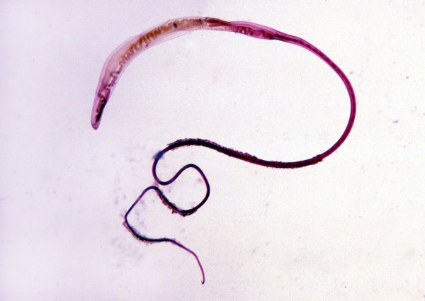 Власоглав Trichocephalus Trichiurus