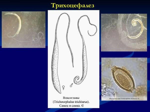 Власоглав Trichocephalus Trichiurus