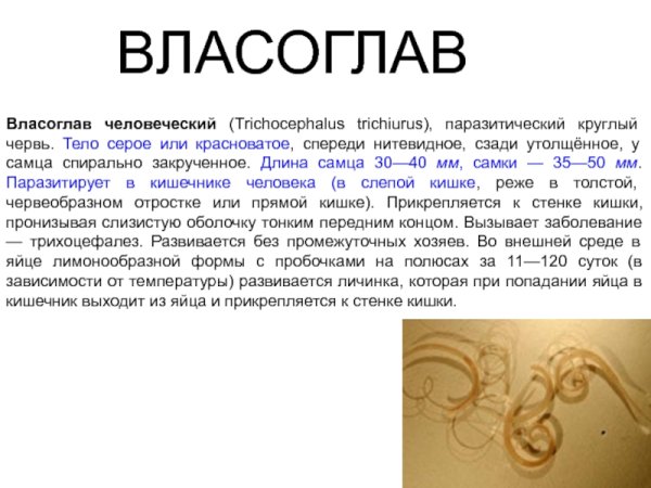 Власоглав Trichocephalus Trichiurus