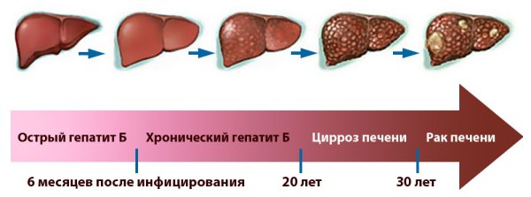 Вирусный гепатит д печень