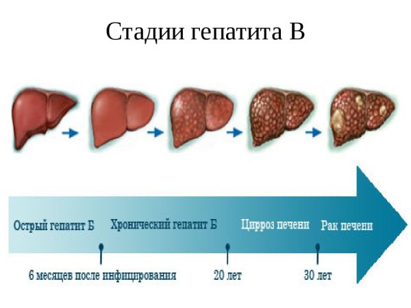 Воспалительные заболевания печени