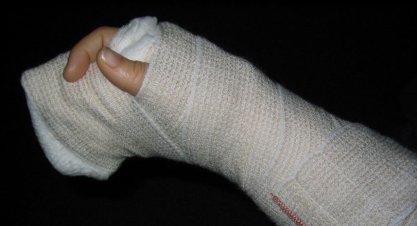 Orthoforma Cast 15см