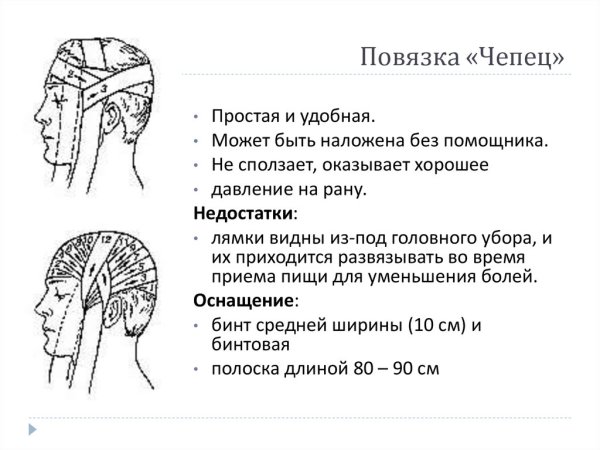 Техника наложения повязки чепец алгоритм