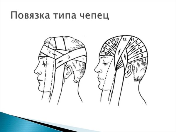 Чепец перевязка схема