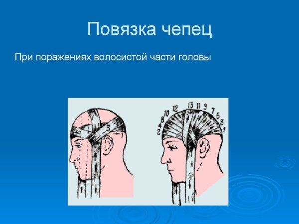 Повязка чепец и пращевидная