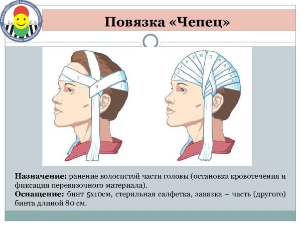 Методика наложения повязки чепец