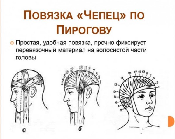 Повязка чепец техника