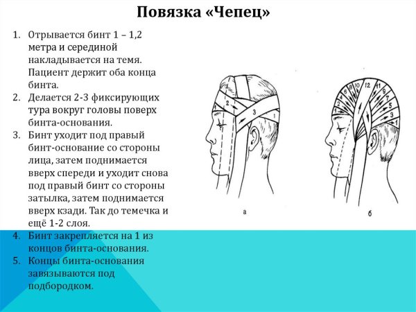 Повязка чепец показания