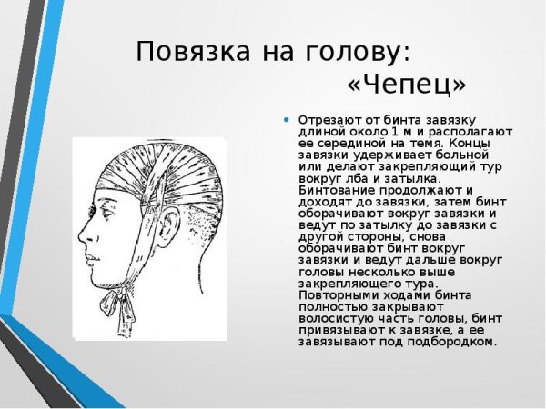 Наложение повязки чепец