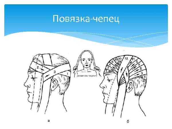 Чепец повязка на голову алгоритм