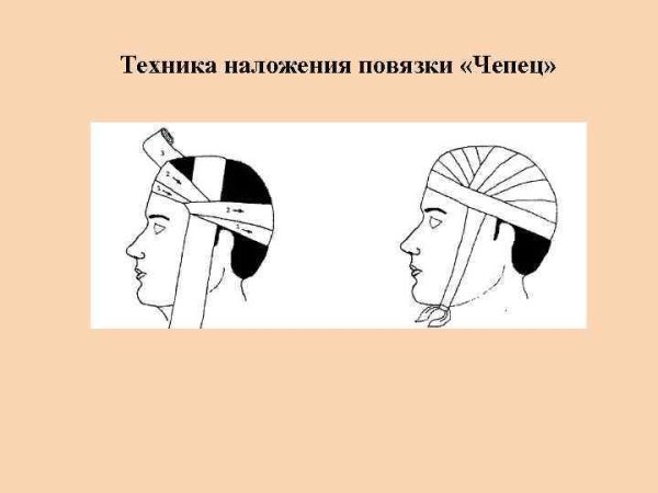 Повязка на голову десмургия чепец