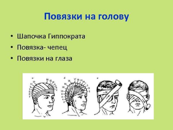 Перевязка головы бинтом чепец