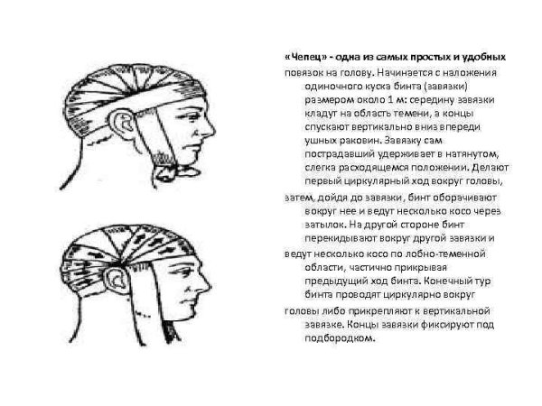 Техника наложения повязки чепец при травме головы