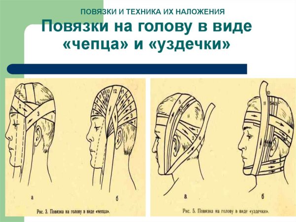Измерить голову при сотрясении