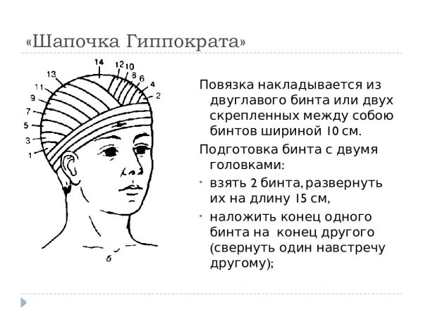 Чепец перевязка схема