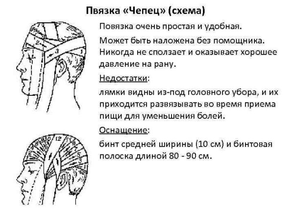 Типы повязок при ранениях головы