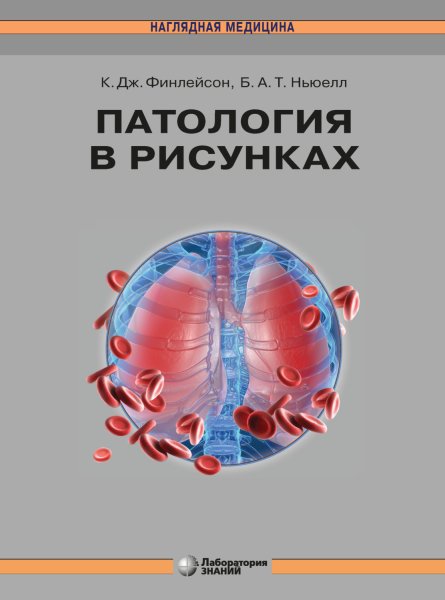 Патология в рисунках к.Дж.Финлейсон