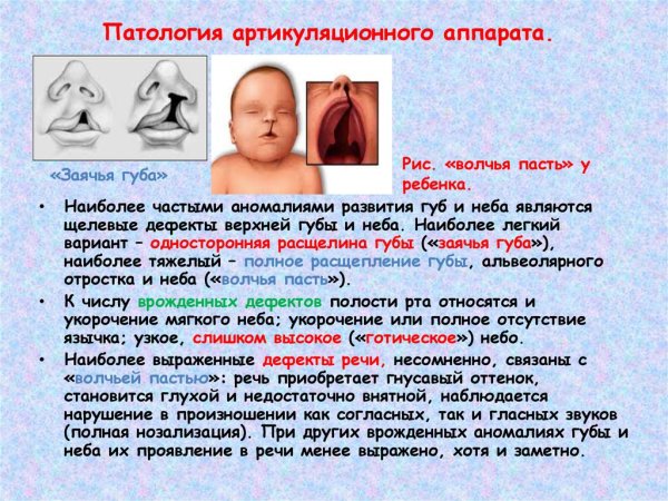 Аномалии развития ротовой полости