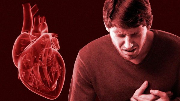 Сердечнососудтстве заболевания
