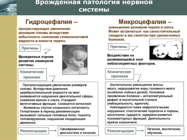 Врожденные заболевания с поражением нервной системы