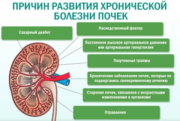 Храническое заболевания почек