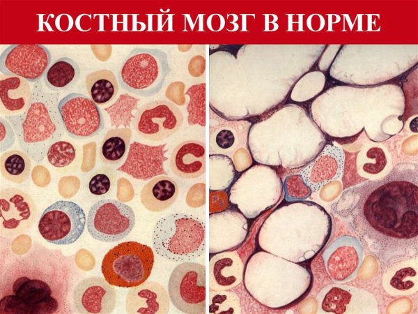 Клетки костного мозга