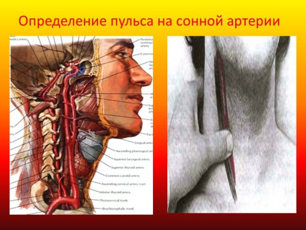 Сонная артерия расположение