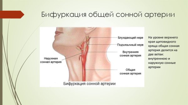 Сонная артерия где находится