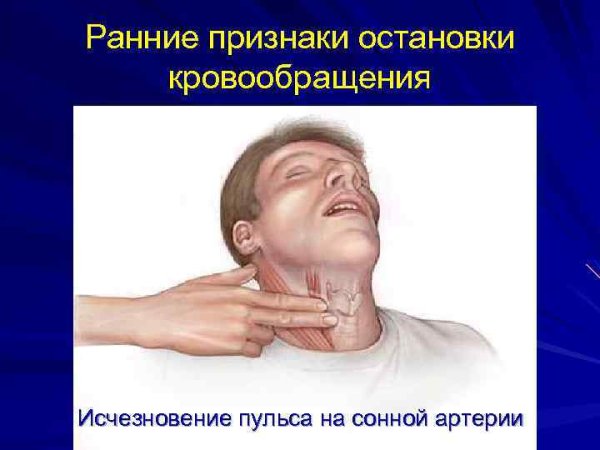 Carotis communis Сонная артерия