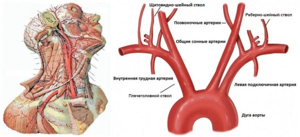 Синус сонной артерии