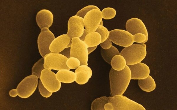 Дрожжи Saccharomyces cerevisiae под микроскопом