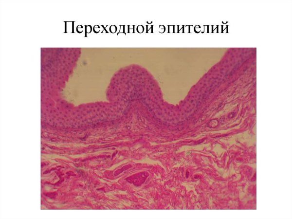 Переходной многослойный эпителий мочевой пузырь