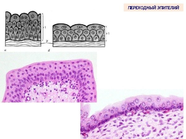 Многослойный переходный эпителий уротелий