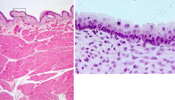 Многослойный переходный эпителий гистология