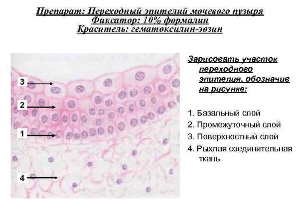 Переходный эпителий мочевого пузыря окраска гематоксилин-эозином